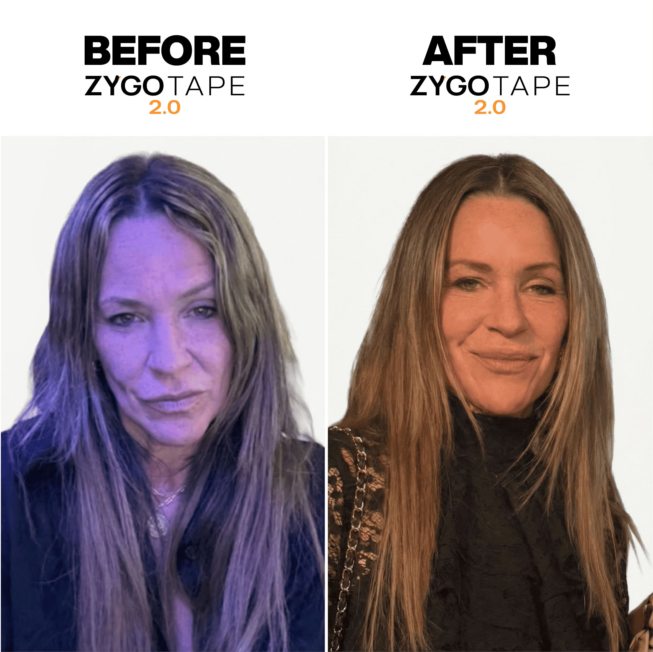 Zygo Tape - Facial Sculpting & Anti-Aging Tape For Women