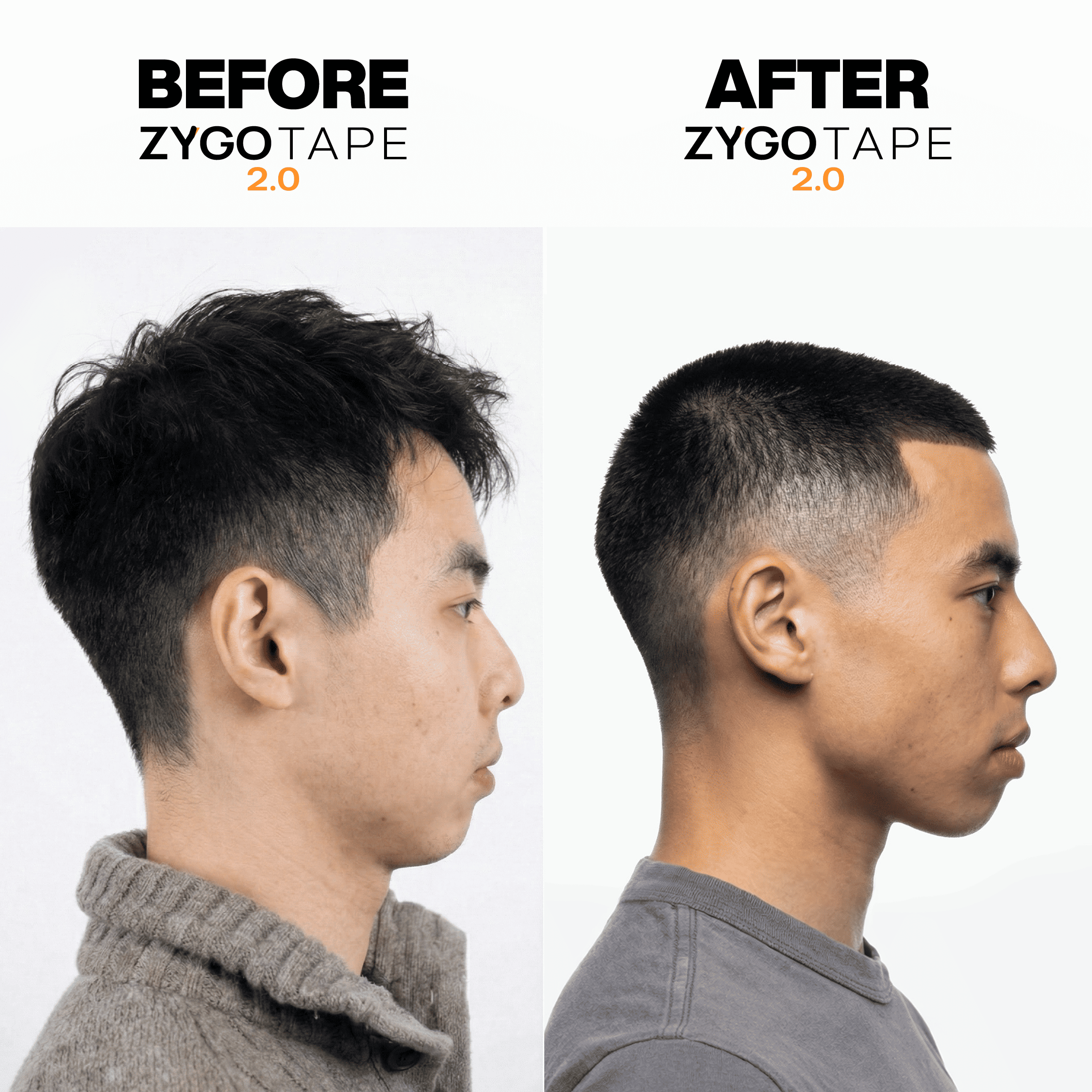 Zygo Tape - Facial Sculpting & Anti-Aging Tape