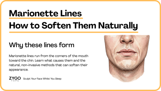 Marionette Lines: Causes and Natural Ways to Soften Them
