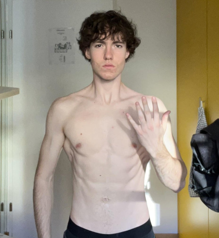 Real results - young man, front on, holding ZygoTape